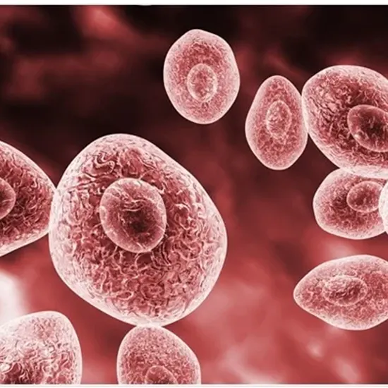 Pneumocystis Pneumonia (PCP)